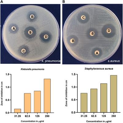 Bactericidal, anti-hemolytic, and anticancerous activities of phytofabricated silver nanoparticles of glycine max seeds